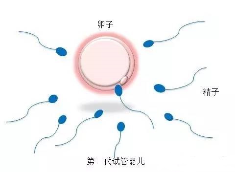 私人志愿者代孕服务怎么选